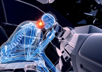 What to Do if You Are Involved in a Rear End Accident?