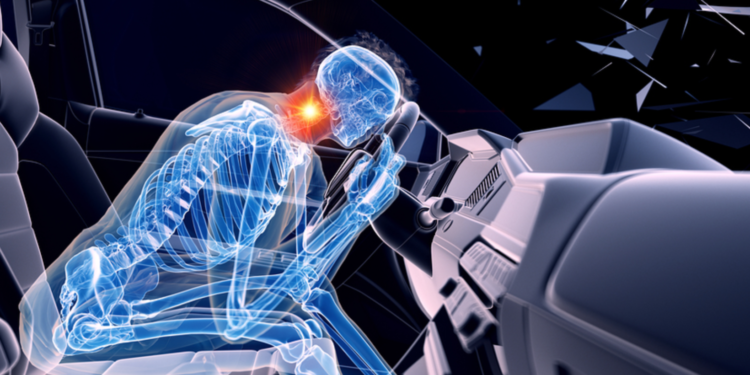 What to Do if You Are Involved in a Rear End Accident?